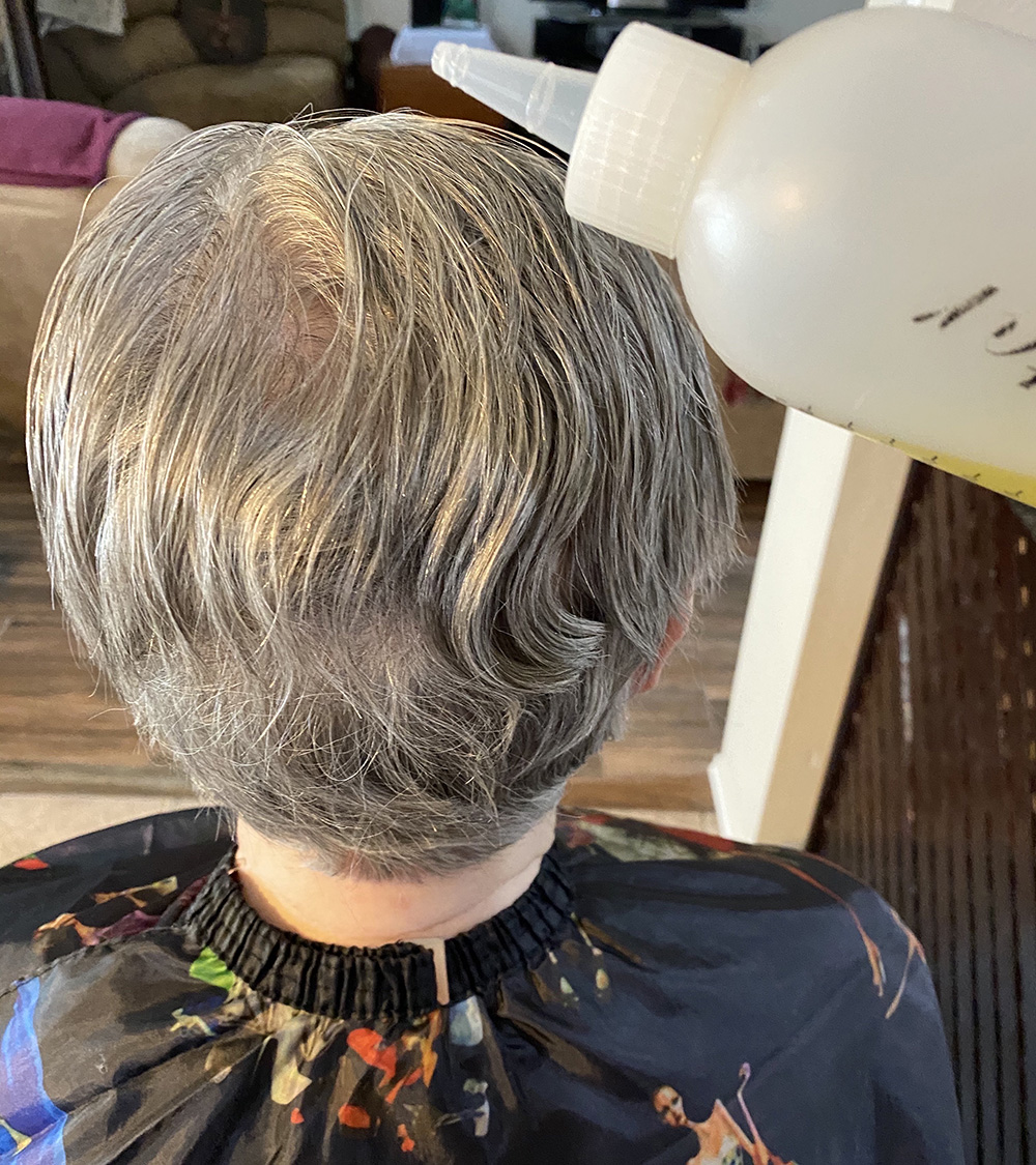 Head Lice Treatment Removal Service in Dallas, Texas LiceDoctors